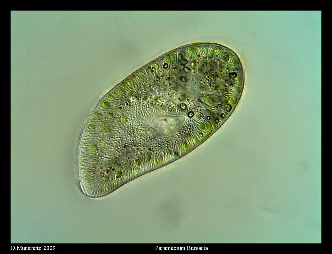 Paramecium Bursaria...400x